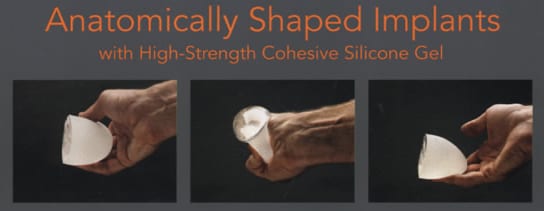 Image of Implant shapes